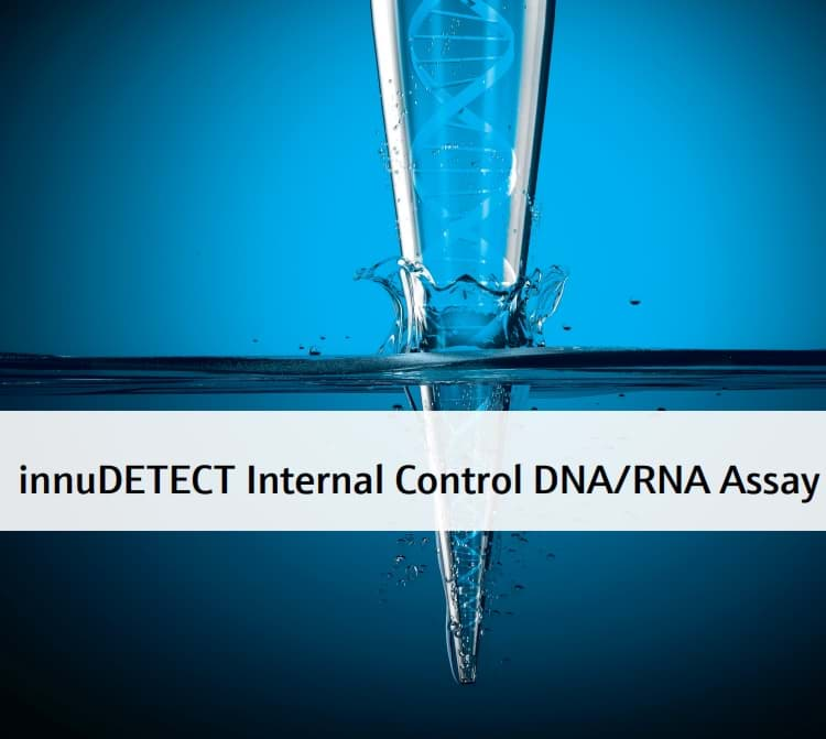 Picture of innuDETECT Internal Control DNA/RNA Assay - 100 reactions of 25 µl